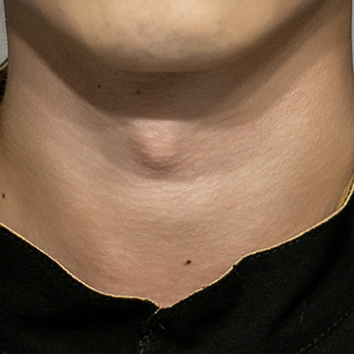 Buddha Stonesカエルボタン 中国龍 吉兆 雲 刺繍 半袖シャツ コットンリネン メンズ 服 - image 9